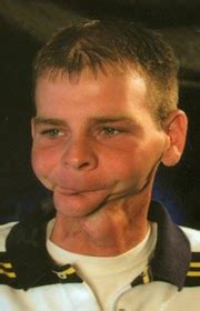 This is natural when conditions do from that day on he never went near another girl. quit because...: Smoke or No Smoke, Tobacco Is Still Deadly