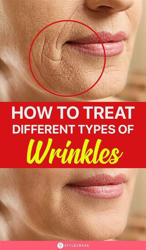 7 Different Types Of Wrinkles And 4 Tips For Treating Them In 2021