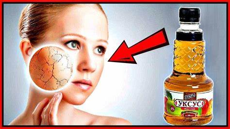 Диета яблочным уксусом