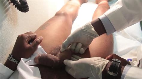 Male Physical Examination Real