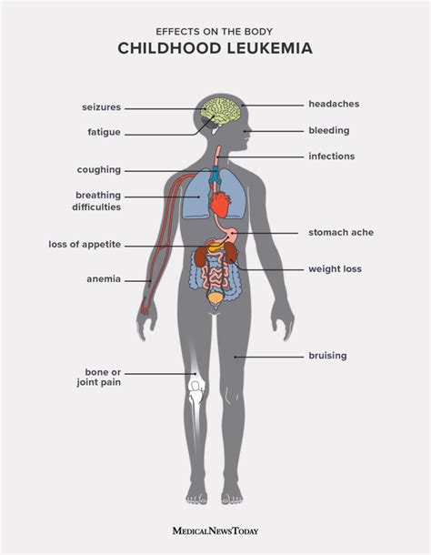 11 Symptoms Of Leukemia In Children