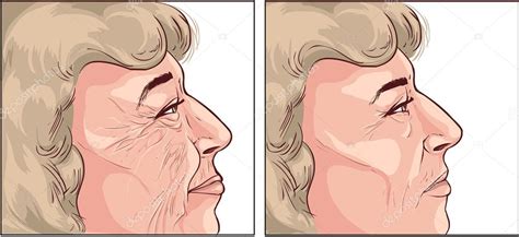 Vector Illustration Of A Face Wrinkles Woman — Stock Vector © 95124076
