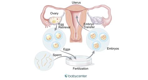 Fertility Treatment In Vitro Fertilization Ivf Babycenter