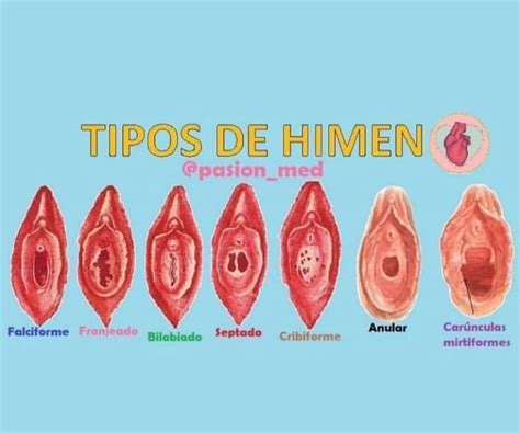 Que Es Himen En La Mujer Arcon