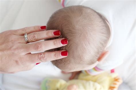 What other treatments are available? How to Treat Dry Scalp in Babies | LIVESTRONG.COM