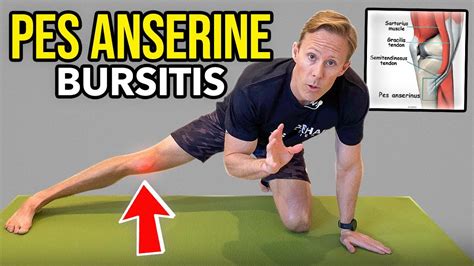 Pes Anserine Bursitis Knee Rehab Exercises YouTube