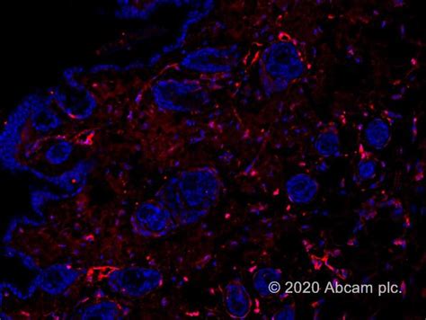 The alexa fluor family of fluorescent dyes is a series of dyes invented by molecular probes, now a part of thermo fisher scientific, and sold under the invitrogen brand name. 山羊抗小鼠IgG H&L (Alexa Fluor® 647)| Abcam中国