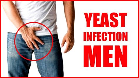 Yeast Infection Men Top Yeast Infection Symptoms And Thrush Causes