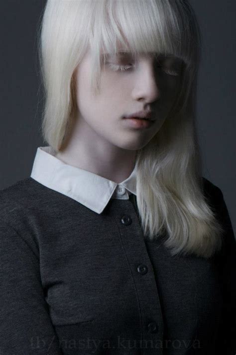 Nastya Kumarova Albino Model Albinism Portrait