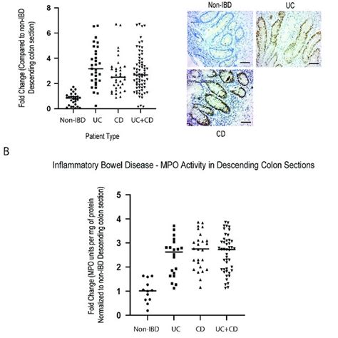 Elevated Activity Of Inflammatory Markers Active Ripk2 And Mpo In Ibd