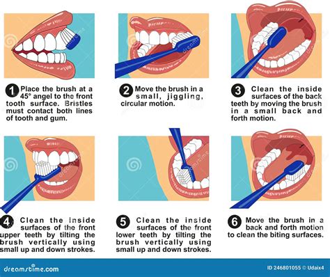 Teeth Infographic Gum Disease Stages Cartoon Vector Cartoondealer Hot Sex Picture