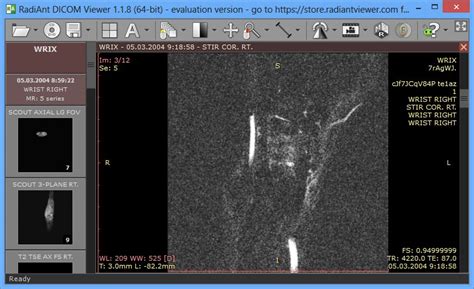 We did not find results for: Free Dicom Viewer Vista - planetdevelopers