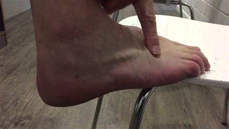 They usually develop on the top of the foot. Large ganglion cyst in the foot - YouTube