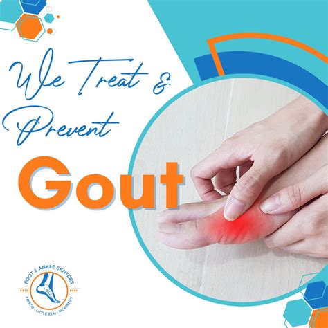 How Do You Treat Gout Foot And Ankle Centers Of Frisco And Plano