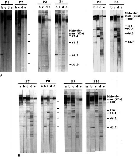 Western Blot Analysis Of Fibronectin Fragments In Normal Human Serum Download Scientific