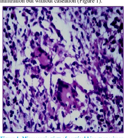 Figure 1 From Tuberculosis Of The Cervix Mimicking Cervical Cancer