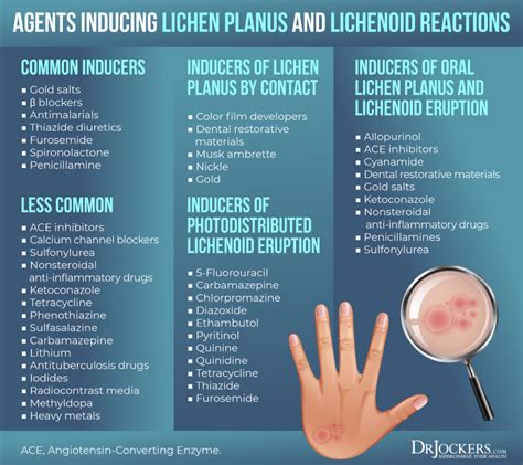 Lichen Planus Symptoms Causes And Support Strategies