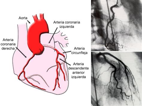 Información General Sobre El Corazón Cardioquirón Servicio De