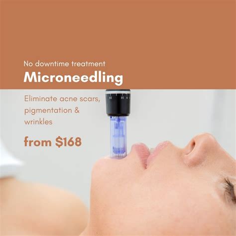Microneedling in singapore