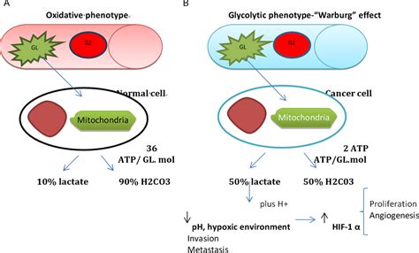 PDF Type B Lactic Acidosis A Rare But Life Threatening Hematologic