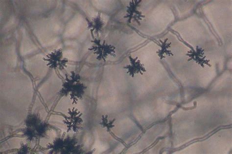 What Is Cladosporium Mold