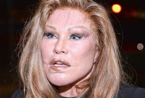 Prima della sua esperienza nel dating show, gianluca de uomini e donne, puntata di oggi: Era bellissima oggi il disastro della chirurgia estetica l ...