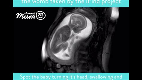 Mri Scan Video Of Baby Moving In Womb Channel Mum Youtube