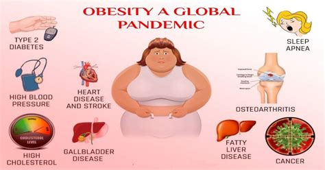Obesity Causes Side Effects Facts And Prevention Arriba Trends