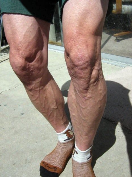 Bald Legged And Beautiful Men Who Shave Their Legs In The Name Of Sport Health Fitness