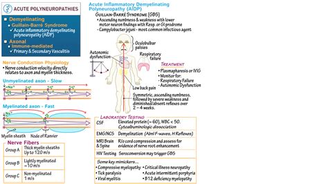 Holter Pathology Ohio University Guillain Barré Syndrome Draw It to