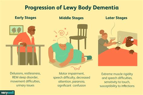 Stadien Und Verlauf Der Lewy Körperchen Demenz