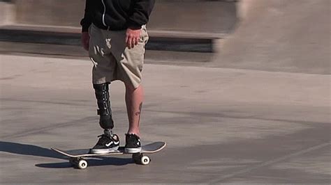 Amputee Skateboarder Hopes To Inspire Others With Disabilities Nbc 5