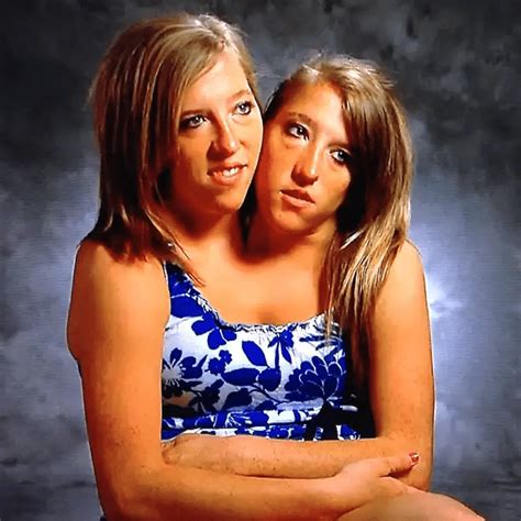 Where Are Conjoined Twins Abby And Brittany Hensel CitiMuzik