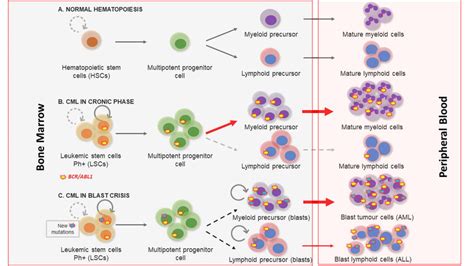 Chronic Myeloid Leukemia Clinical Phases A Normal Hematopoiesis