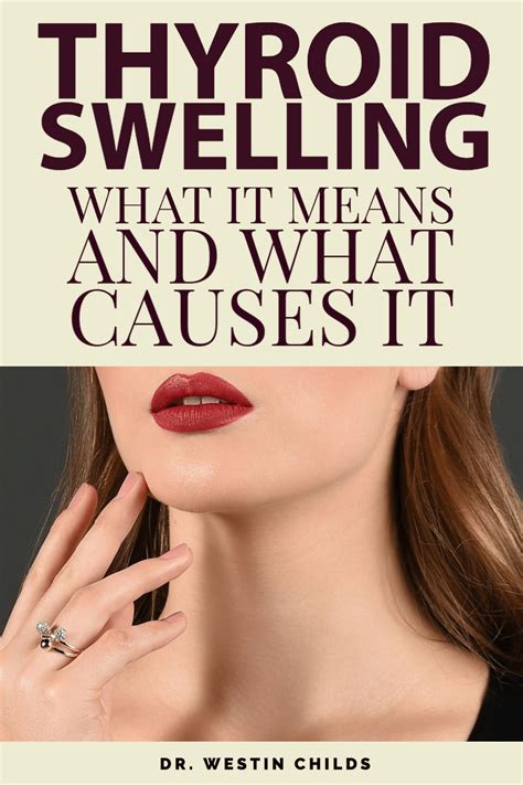 Thyroid Swelling What It Means And What Causes It Artofit