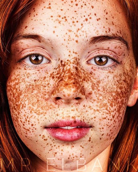 98 Freckled People Who Ll Hypnotize You With Their Unique Beauty