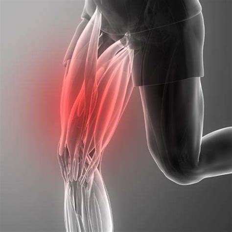 Leg Muscle Pain