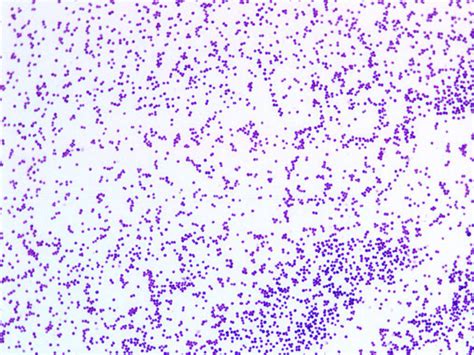 Staphylococcus Aureus Morphology Visualised Using Gram Staining 10×