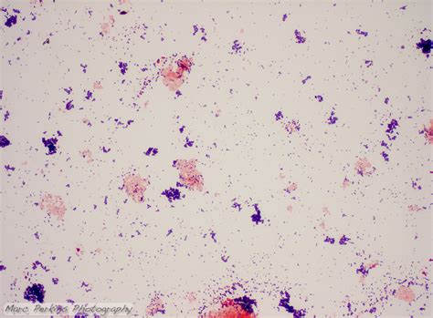 Gram Stain Staphylococcus Aureus