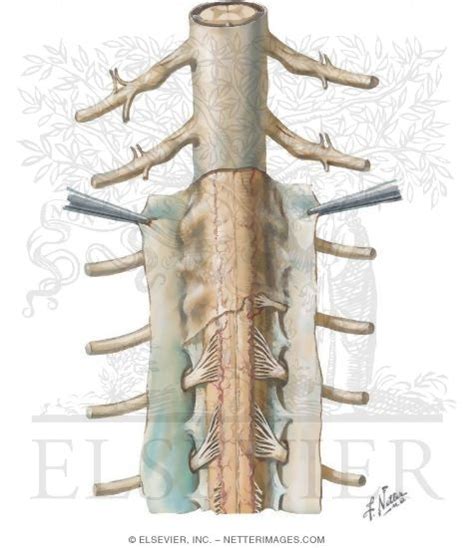 Spinal Meninges