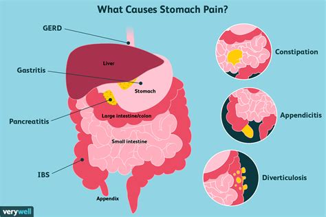 Where Is Gastric Pain Located