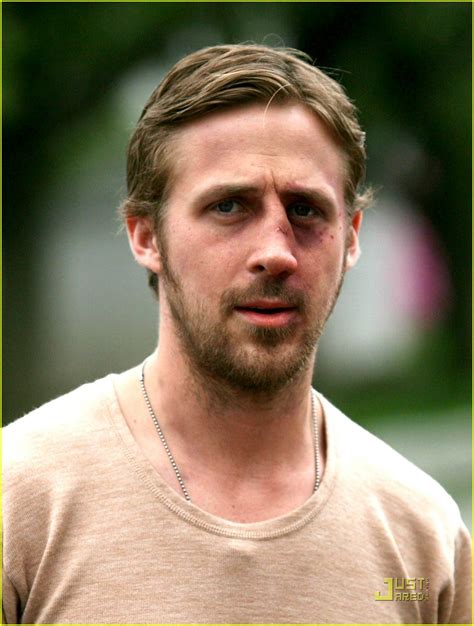 Ryan Gosling Gets A Black Eye Photo 1906891 Photos Just Jared Celebrity News And Gossip