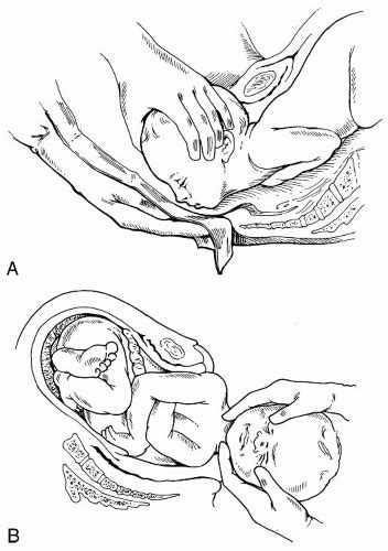 craniosacral therapy obgyn key