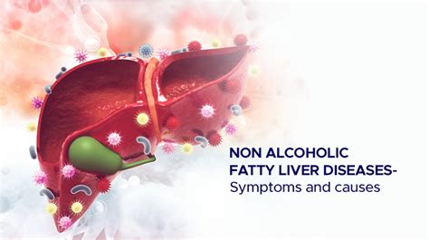 Non Alcoholic Fatty Liver Diseases Symptoms And Causes Ailbs India