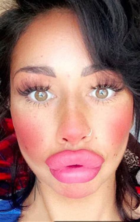 This Woman Wants To Take Her Huge Lips And Make Them Even Bigger Pics