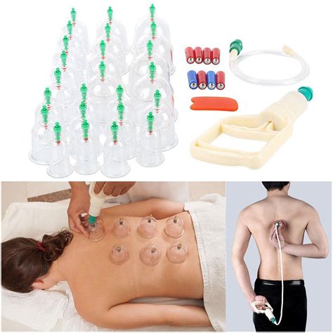 Hijama Medical Vacuum Cupping Suction Therapy Device Set 12 Cups Sale Price Buy Online In