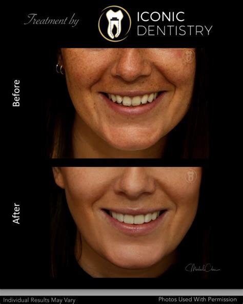 iconic dentistry smile gallery