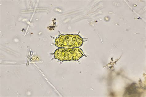 Xanthidium Antilopaeum The Microscopic Life Of Shetland Lochs