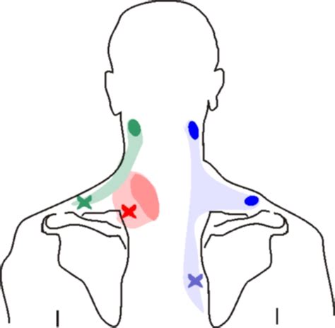 Neck Pain Left Side Physiosunit