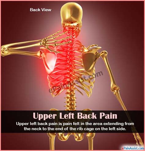 Thinking back, one of the symptoms i had (at the time, i didn't pay attention) was pain in the lower left rib cage. Upper Left Back Pain|Causes|Symptoms|Treatment|Diagnosis